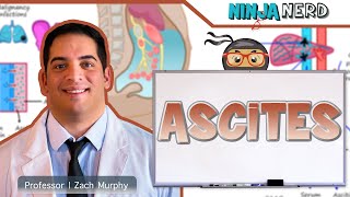 Ascites  Clinical Medicine [upl. by Rehpotsirh238]