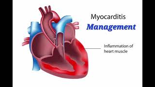 Myocarditis History Management mrcpch Clinical [upl. by Trixi]