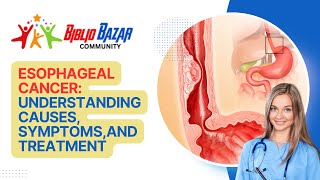 🩺 Understanding Esophageal Cancer Symptoms Treatment and Care 🩺 [upl. by Ayekam]