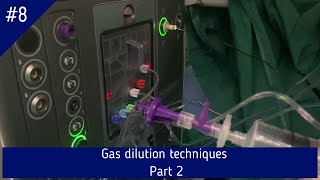 Gas dilution techniques in retinal detachment surgery Part 2 [upl. by Ahsienet341]