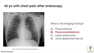 High Yield Radiology for USMLE Step 1 Adult Respiratory Part 1 [upl. by Alten]