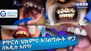 የጥርስ ህክምና አገልግሎት ዋጋ በአዲስ አበባ  Tooth clinic Price in Addis Ababa Ethiopia  Ethio Review [upl. by Cappello244]