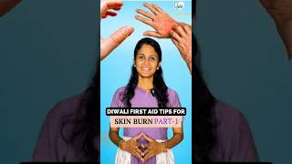 Diwali First Aid Tips For Skin Burn  Must Watch [upl. by Aenej]