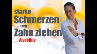 STARKE Schmerzen nach Zahn ziehen WAS kann ich WIE machen ALVEOLITIS [upl. by Elvina540]