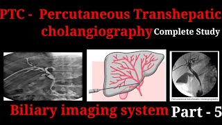 Percutaneous Transhepatic Cholangiography  PTC  Procedure  Biliary imaging system part  5 [upl. by Anawqahs]