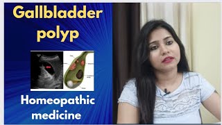 Gallbladder polyp homeopathic medicine  Gallbladder polyp symptomscauses amp homeopathic treatment [upl. by Alana]