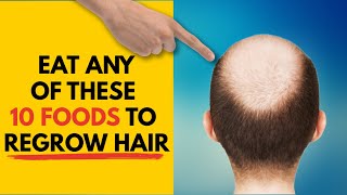 10 Best Foods To Regrow Your Hair  Foods for Hair Growth [upl. by Yeltnarb955]