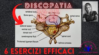 DISCOPATIA LOMBARE L4L5L5S1  6 ESERCIZI EFFICACI [upl. by Irbua296]