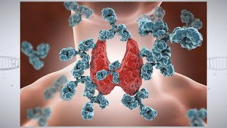 Understanding Autoimmune Thyroid Disease [upl. by Ailemaj]