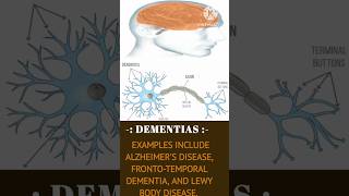 Dementias Lewy body disease Alzheimers shortvideosci [upl. by Eural]