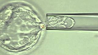 Trophectoderm Biopsy using Hamilton Thorne laser [upl. by Yelrak]