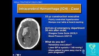 Intracerebral Hemorrhage Case Study  Health4TheWorld Academy [upl. by Flower]