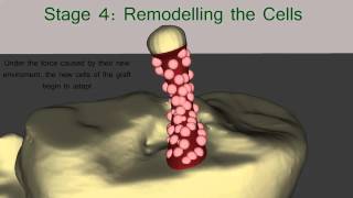 The Healing Process of the ACL Graft [upl. by Eiger]