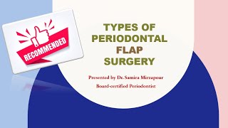 Periodontal Flap Surgery for Periodontitis [upl. by Michey144]