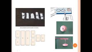 Operative Dentistry Lec 9 Dental cements Base materials [upl. by Dreher]