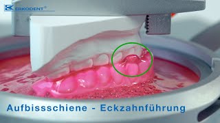 Aufbissschiene – Eckzahnführung [upl. by Oilla]