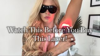 Ulike Laser Hair Removal Device Review [upl. by Nickerson]