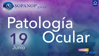 Patología Ocular [upl. by Hoyt]