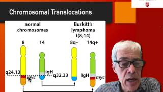 25 The case of Burkitt’s lymphoma [upl. by Yemac877]