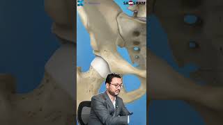 When is Hip Replacement Surgery Necessary 🏥  Dr Debashish Chanda [upl. by Karyl]