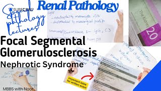 focal segmental glomerulosclerosis  nephrotic syndrome  renal pathology  selflessmedicose [upl. by Atinrahc922]