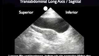 Anleitung FASTUntersuchung – suprapubische Darstellungen [upl. by Orth368]