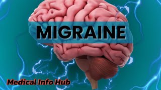 Migraine Headache Relief Migraine ka ilaj Migraine symptoms Migraine painMigraine [upl. by Adlei]