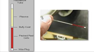 How to Measure the Hematocrit  physio lab practical [upl. by Hughes]