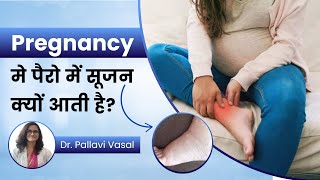 How to Reduce Swelling in Legs During Pregnancy Dr Pallavi Vasal [upl. by Gasparo705]