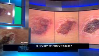 The Dangers of Picking Scabs Medical Course [upl. by Obel702]