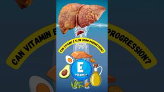 Can Vitamin E Slow Down Progression of Fatty Liver Disease NAFLD [upl. by Ladnyc920]