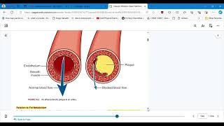 NUTRITION CHAPTER 19 CORONARY HEART DISEASE AND HYPERTENSION  PART 1 [upl. by Carothers]