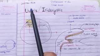 Uveitis Iridocyclitis theory examination notes AK khurana [upl. by Relyuc]