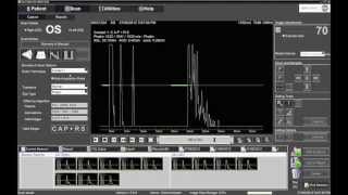 Performing Contact Biometry with the Ellex Eye Cubed [upl. by Nnaegroeg]