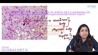 SYSTEMIC PATHOLOGY IMAGES PART 2 By Dr Illa jain khandelwal Pathology by Marrow Video Lecture [upl. by Aicital]