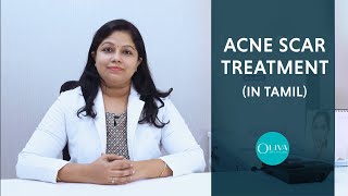 Best Treatment For Acne Scars And Pimple Marks Tamil  முகபரு வடு விடுபட [upl. by Kcirdek]