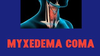 Myxedema coma  Hypothyroidism [upl. by Nelehyram783]