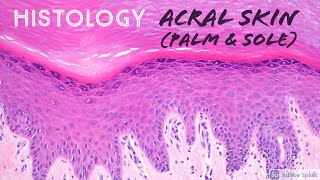 Skin Histology Acral Skin aka glabrous skin of palm of hand amp sole of foot [upl. by Swanhilda]