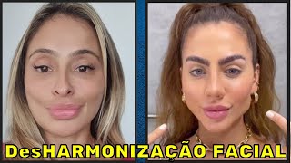 HARMONIZAÇÃO FACIAL Vem ver como tirar Papada e Definir Contorno do Rosto sem Gastar Naturalmente [upl. by Nikolai]