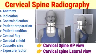 Cervical Spine Radiography  AP amp Lateral Projection  Patient position  In hindi  By BL Kumawat [upl. by Elaen534]