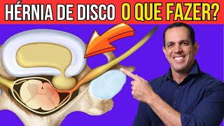 🔴 HÉRNIA DE DISCO  Quais são os SINTOMAS e como TRATAR [upl. by Uela]