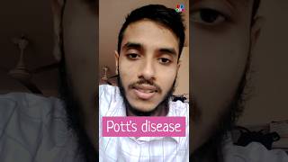 Potts disease  TB  Tuberculosis  Tubercular osteomyelitis  Dr Med [upl. by Ahsaten]