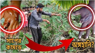 অঙ্গহানির জন্য দায়ী এই সাপ Russells Viper Fatality  বিশাল চন্দ্রবোড়া সাপSnakeSaverBrothers [upl. by Ajat]