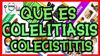 QUÉ ES COLELITIASIS Y COLECISTITIS  GuiaMed [upl. by Mosra]