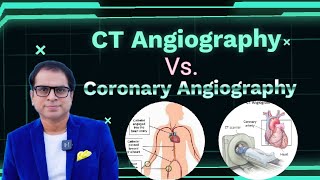 CT Angiography or Coronary Angiography में से कौन सी है बेहतर और आपको कोनसी करवाना चाहिए [upl. by Camala]