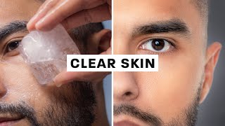 How To Get Clear Skin Science Based [upl. by Manlove381]