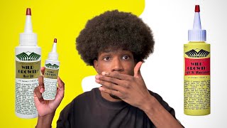 Which bottle Is Better For Hair Growth  Wild Growth Hair Oil Review [upl. by Stanfield]