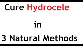 Natural ways to treat Hydrocele [upl. by Howell]