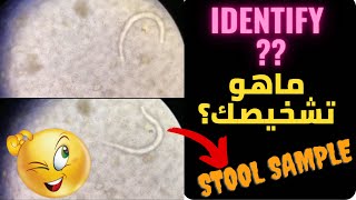 Identify series 2سلسلة ماهو التشخيص 2 [upl. by Romeo]