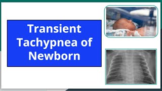 Transient tachypnea of newborn mbbs newbornneonatology neetpg pediatrics nursing ttn [upl. by Friedrick]